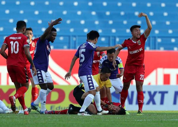 Nuốt Lưỡi Trong Bóng Đá Là Gì? Hướng Dẫn Sơ Cứu Tình Huống